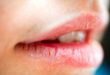 چروک لب و راه های طبیعی برای جلوگیری از آن