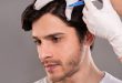 هر آنچه درباره مزوتراپی مو باید بدانید