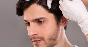 هر آنچه درباره مزوتراپی مو باید بدانید